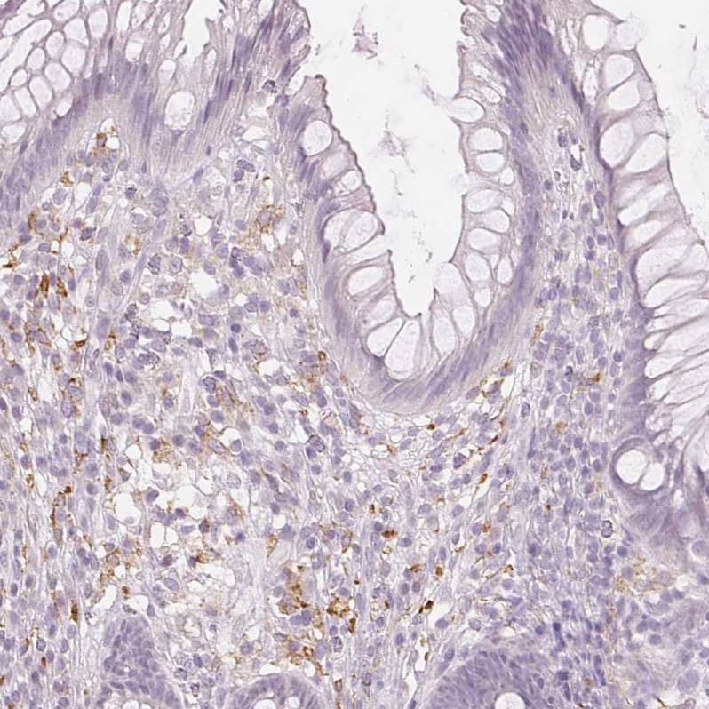 Staining of human rectum shows moderate positivity in lymphoid cells.