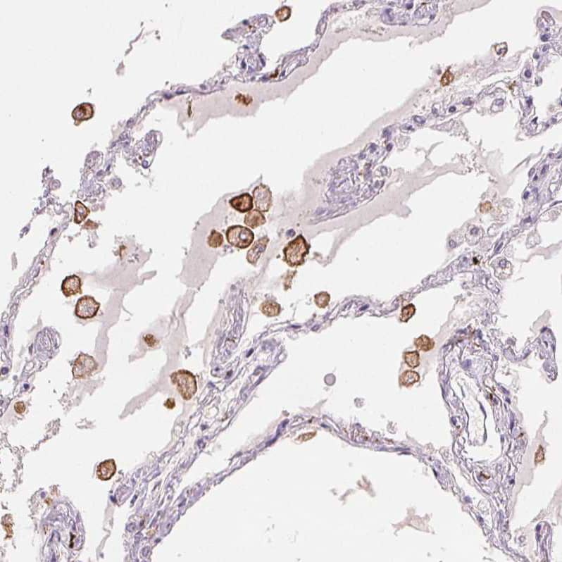 Staining of human lung shows strong membranous positivity in macrophages.