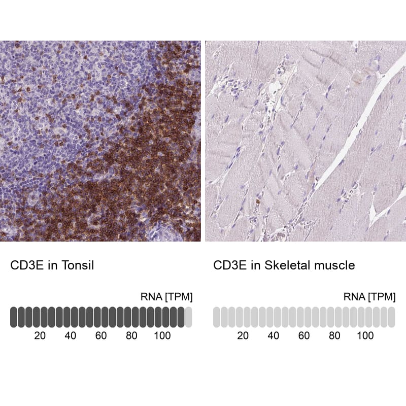 Analysis in human tonsil and skeletal muscle tissues using NBP3-43997 antibody. Corresponding CD3 epsilon RNA-seq data are presented for the same tissues.