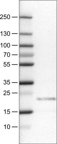 Lane 1: Marker [kDa]Lane 2:  Human tonsil tissue lysate