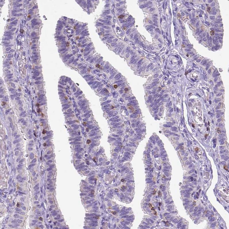 Staining of human fallopian tube shows moderate membranous positivity in lymphoid cells.