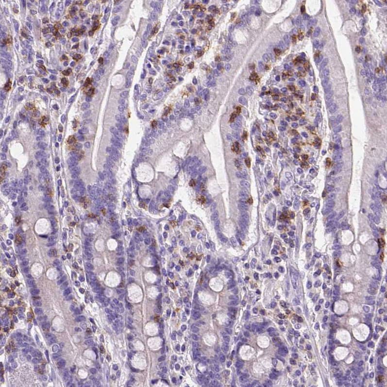 Staining of human small intestine shows strong membranous positivity in lymphoid cells.