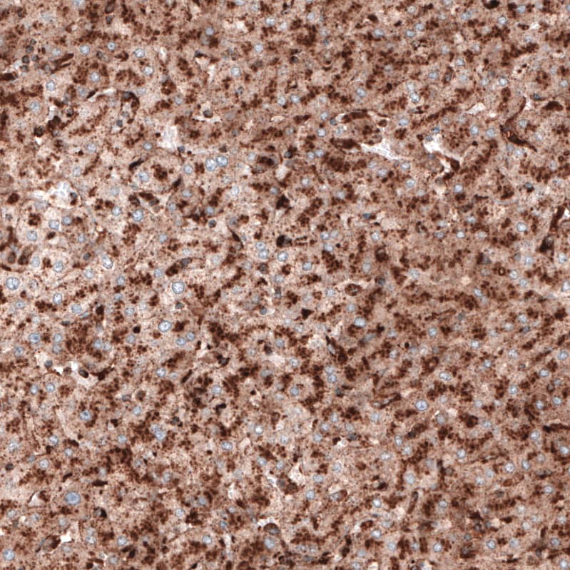 Staining of human liver shows strong granular cytoplasmic positivity in hepatocytes.