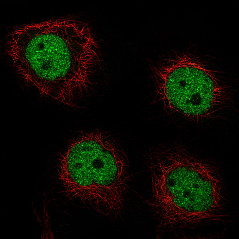 Staining of A-431 cells using the Anti-GRHL2 monoclonal antibody) .