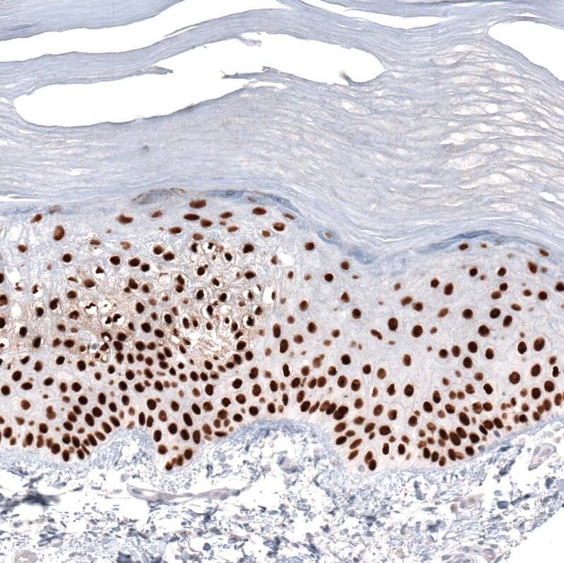 Staining of human skin shows strong nuclear positivity in squamous epithelial cells.