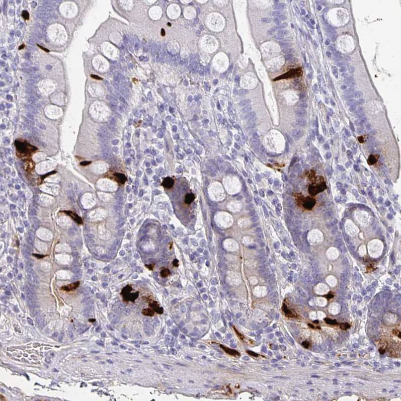 Staining of human duodenum shows strong cytoplasmic positivity in enteroendocrine cells.