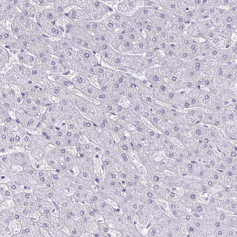 Staining of human liver shows no positivity in hepatocytes as expected.