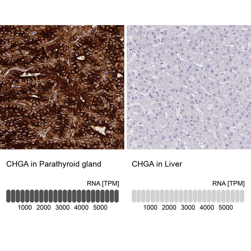 Analysis in human parathyroid gland and liver tissues using NBP3-44001 antibody. Corresponding Chromogranin A RNA-seq data are presented for the same tissues.