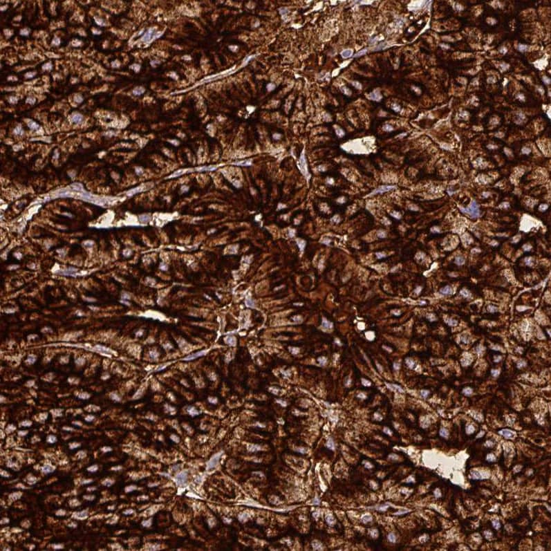 Staining of human parathyroid gland shows strong cytoplasmic positivity in glandular cells.