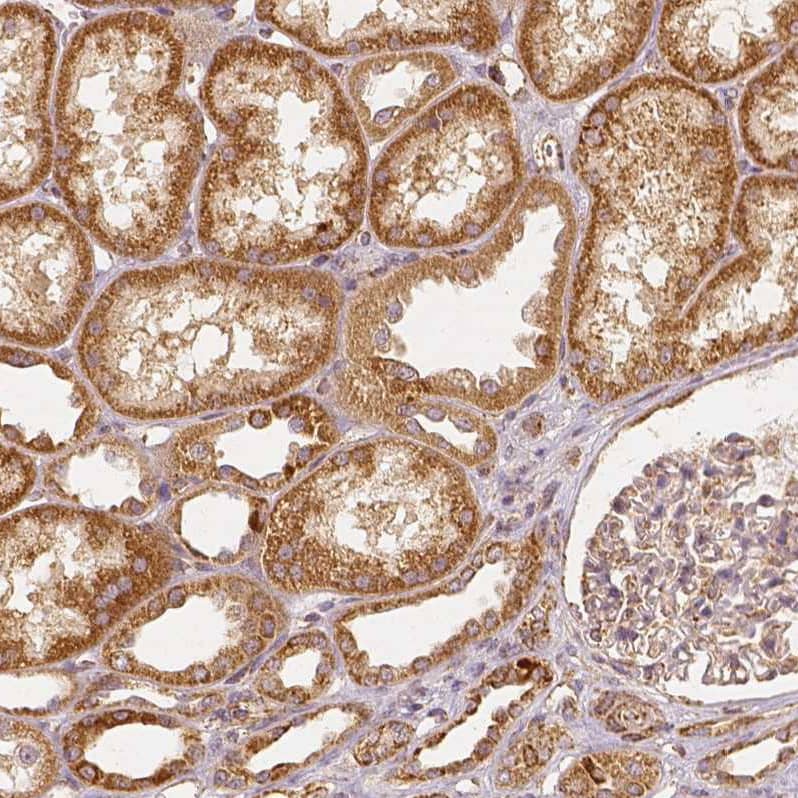 Staining of human kidney shows strong granular cytoplasmic positivity in cells in tubules.