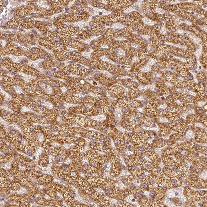 Staining of human liver shows strong granular cytoplasmic positivity in hepatocytes.