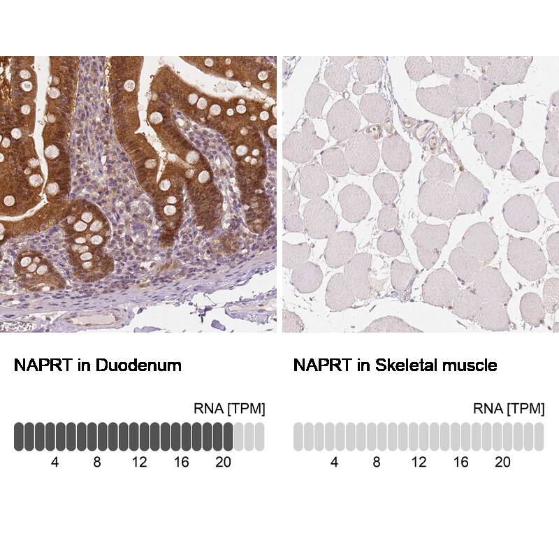 Analysis in human duodenum and skeletal muscle tissues using NBP3-44003 antibody. Corresponding NAPRT1 RNA-seq data are presented for the same tissues.