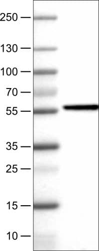 Lane 1: Marker [kDa]Lane 2: Human liver tissue lysate