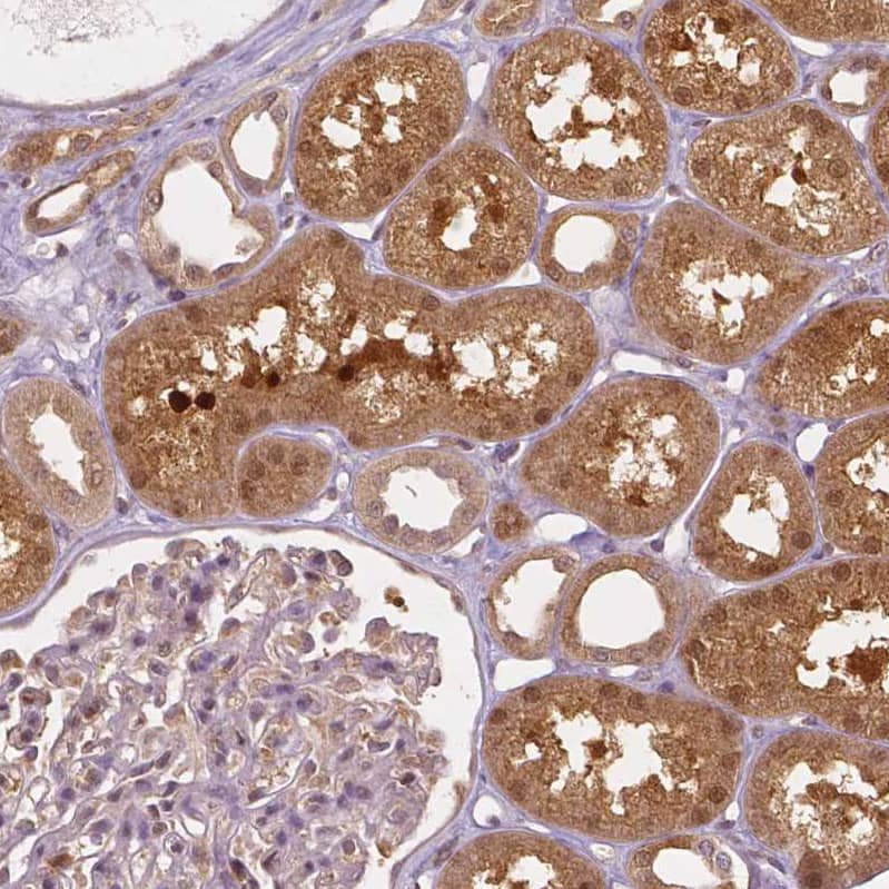 Staining of human kidney shows strong cytoplasmic positivity in cells in tubules.