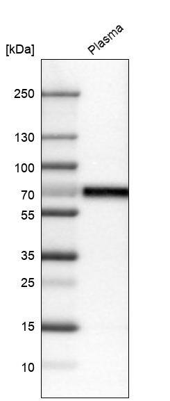 Analysis in human plasma.