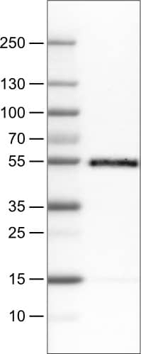 Lane 1: Marker [kDa]Lane 2: Human tonsil tissue lysate