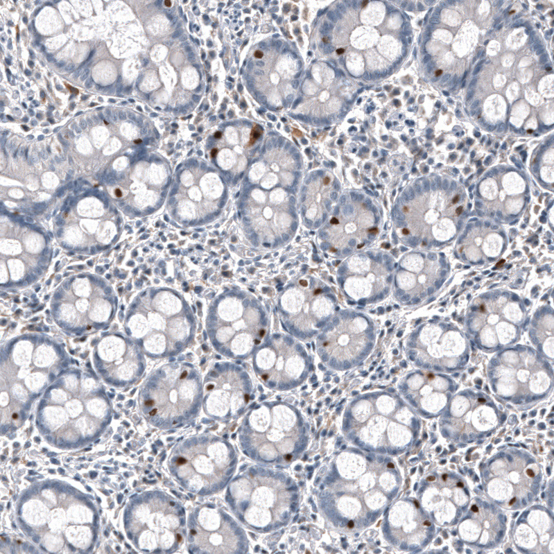 Staining of human duodenum shows strong nuclear positivity in subset of glandular cells.
