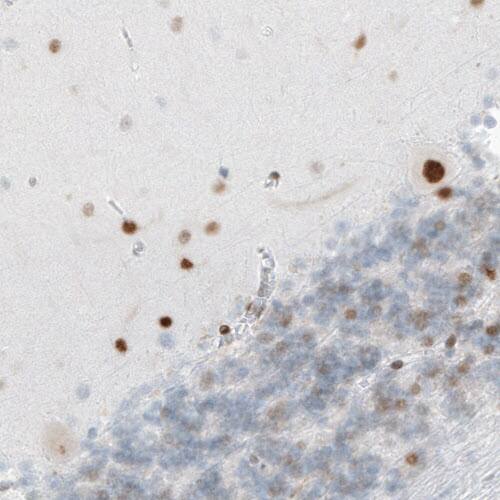 Staining of human cerebellum shows nuclear immunoreactivity in Purkinje cells, as well as in neuronal cells in the granular and molecular layers.