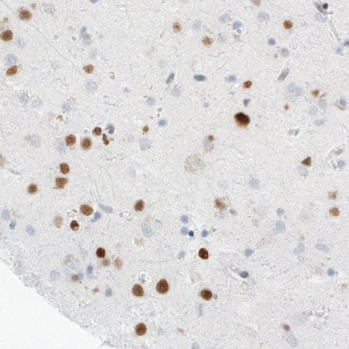 Staining of human cerebral cortex shows nuclear immunoreactivity in a subset of neurons.