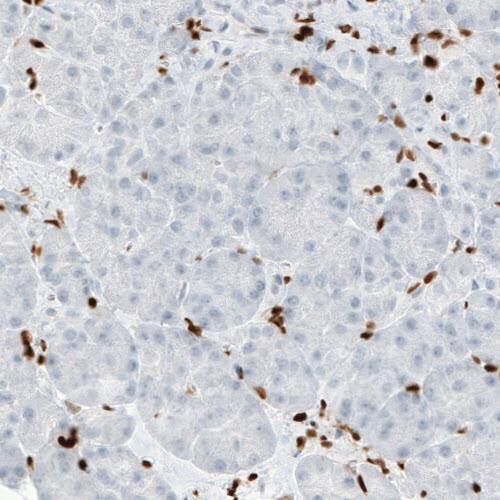 Staining of human pancreas shows absence of staining in the exocrine glandular cells (negative control).