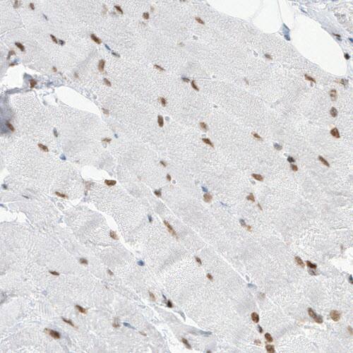 Staining of human skeletal muscle shows distinct nuclear positivity in the muscle fibers.