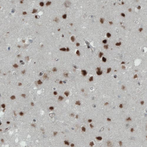 Staining of human cerebral cortex shows strong immunoreactivity in neuronal cells.