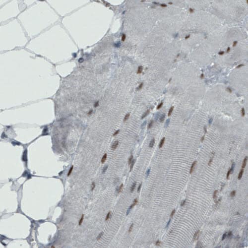 Staining of human skeletal muscle shows moderate nuclear positivity in muscle fibers.