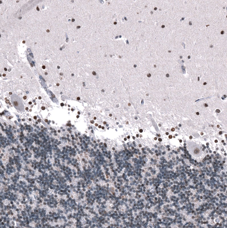 Staining of human cerebellum shows moderate nuclear positivity in Purkinje cells, as well as in neurons in molecular layer.