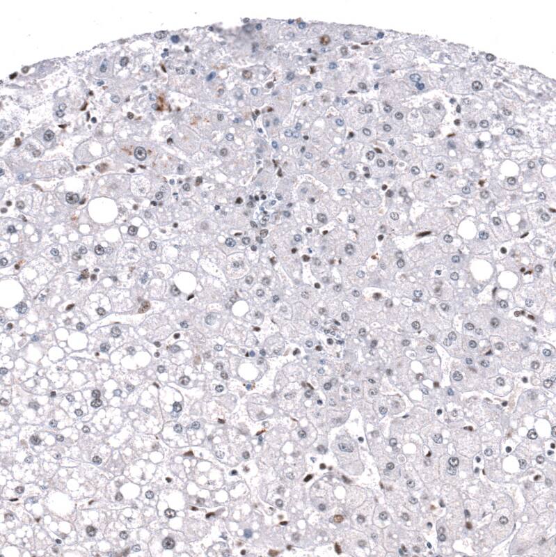 Staining of human liver shows no positivity in hepatocytes as expected.