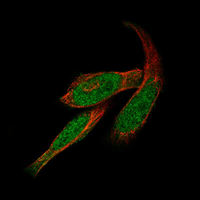Staining of RH-30 cells using the Anti-GLI-1 monoclonal antibody) . 