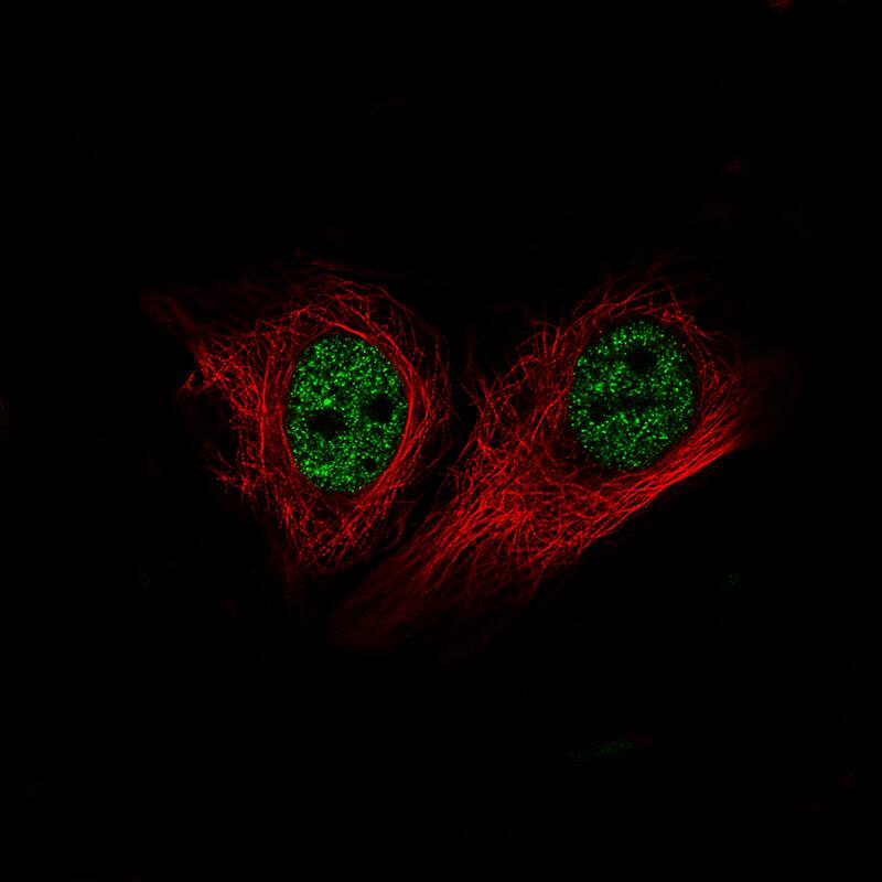 Staining of MCF-7 cells using the Anti-BRD4 monoclonal antibody) .