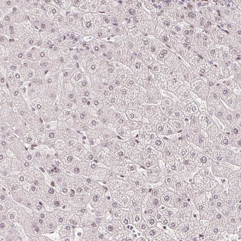 Staining of human liver shows no nuclear positivity in hepatocytes as expected.