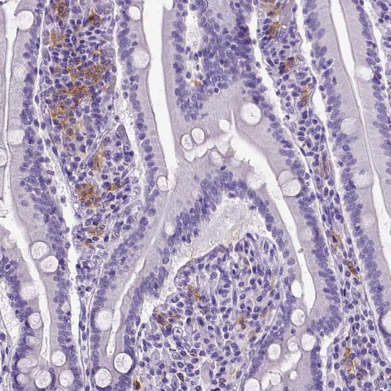 Staining of human small intestine shows moderate positivity in a subset of lymphoid cells.
