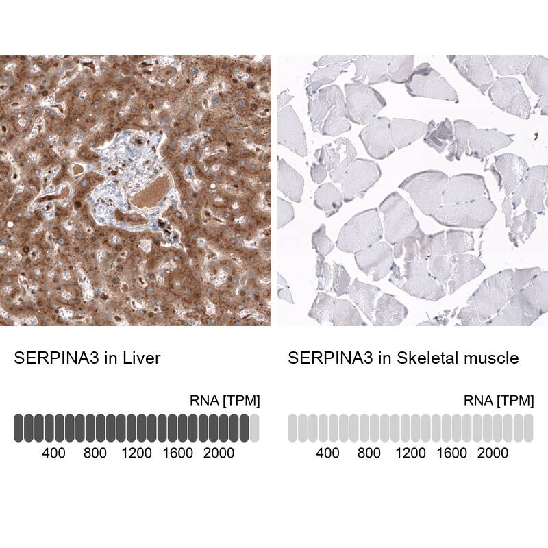 Analysis in human liver and skeletal muscle tissues using NBP3-44021 antibody. Corresponding Serpin A3/alpha 1-Antichymotrypsin RNA-seq data are presented for the same tissues.