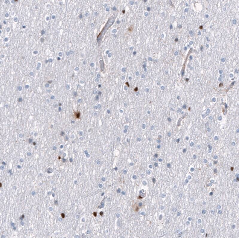 Staining of human cerebral cortex shows cytoplasmic and nuclear positivity in a subset of glial cells.