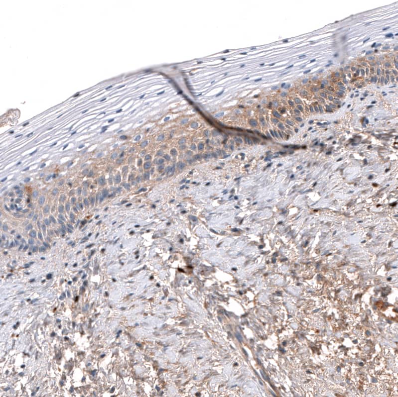 Staining of human uterine cervix shows moderate cytoplasmic positivity in squamous epithelial cells.
