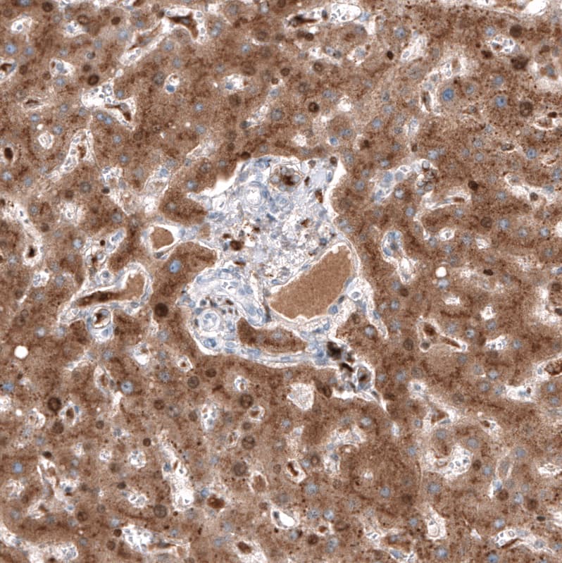 Staining of human liver shows strong cytoplasmic positivity in hepatocytes.