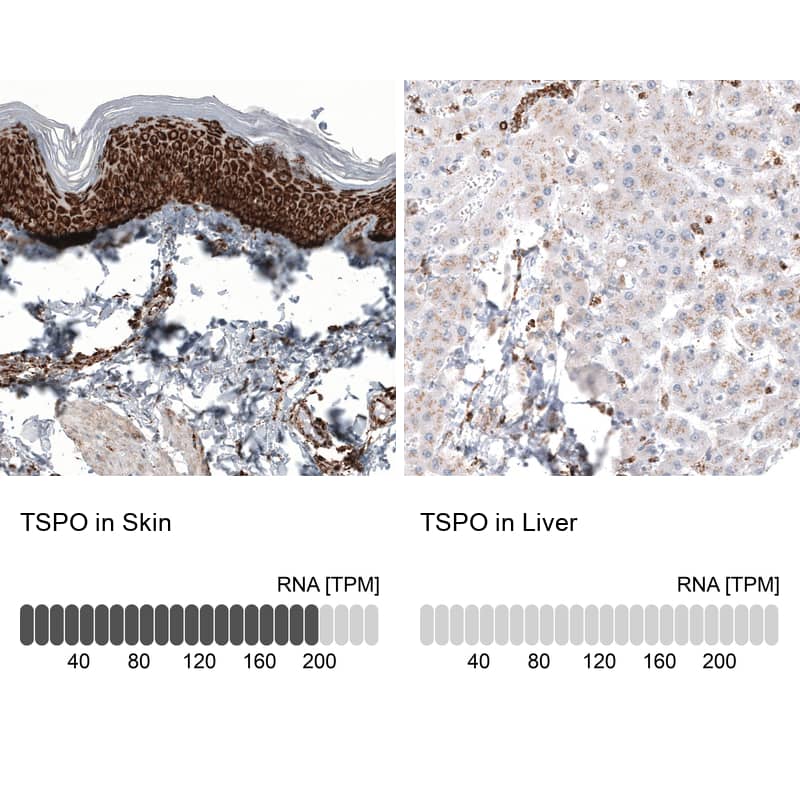 <b>Orthogonal Strategies Validation. </b>Analysis in human skin and liver tissues using NBP3-44022 antibody. Corresponding PBR RNA-seq data are presented for the same tissues.