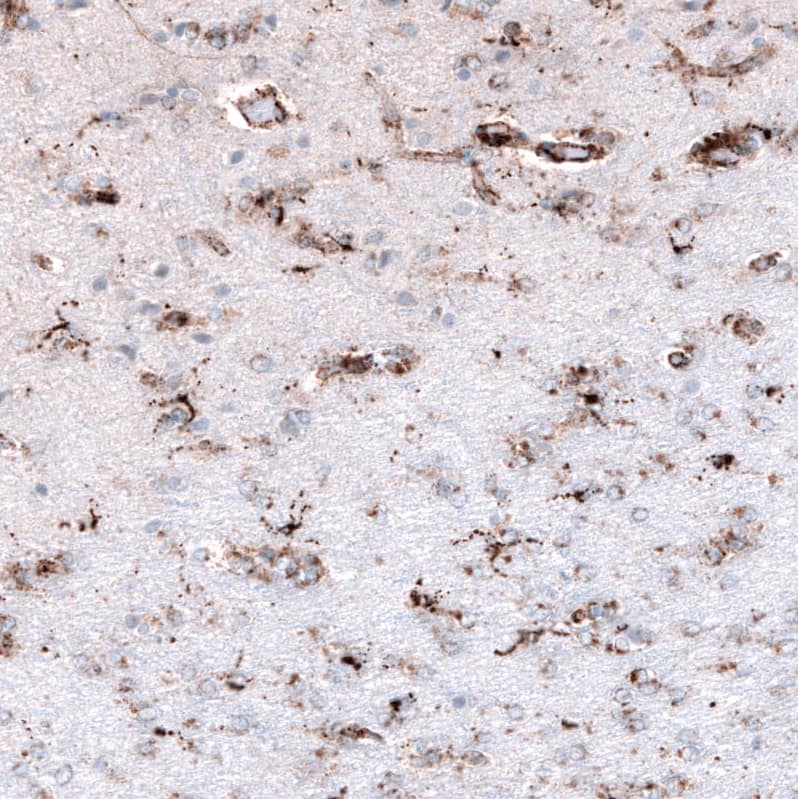 Staining of human cerebral cortex shows moderate granular positivity in glial cells.