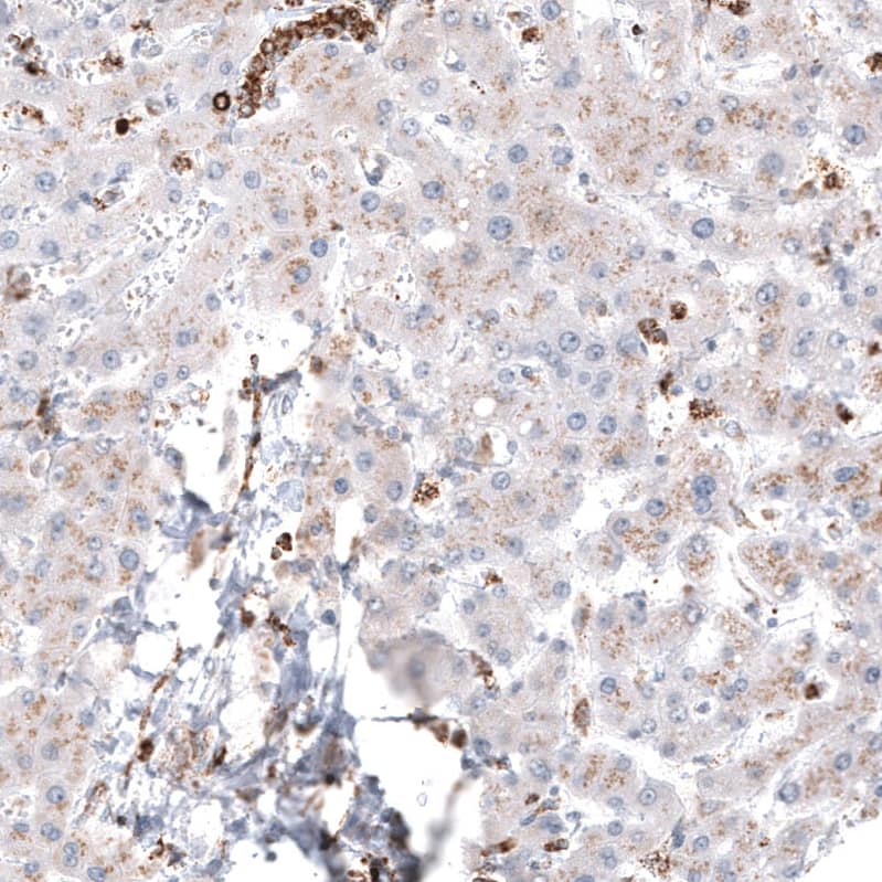Staining of human liver shows weak cytoplasmic positivity in hepatocytes.