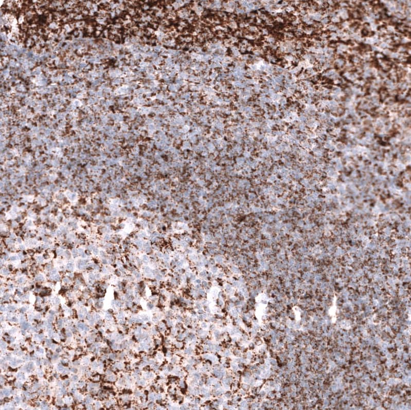 Staining of human tonsil shows moderate to strong granular positivity in lymphoid cells.