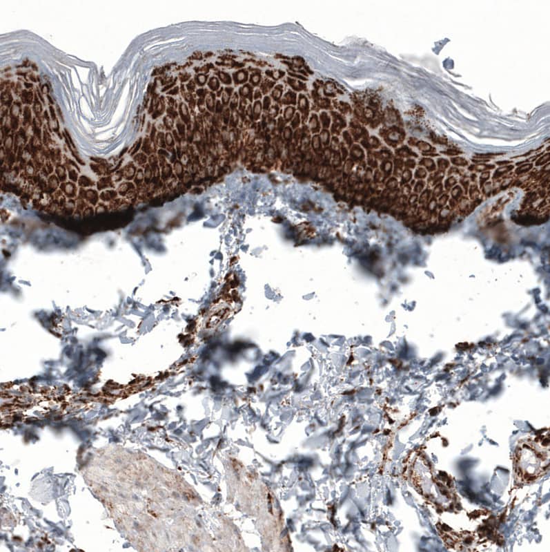 Staining of human skin shows strong granular cytoplasmic positivity in squamous epithelial cells.