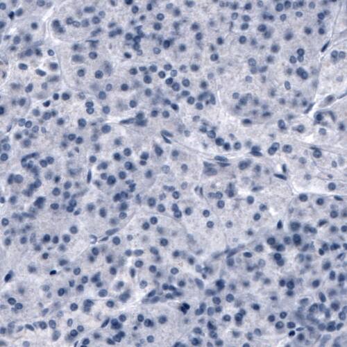 Staining of human pancreas shows absence of immunoreactivity (negative control).