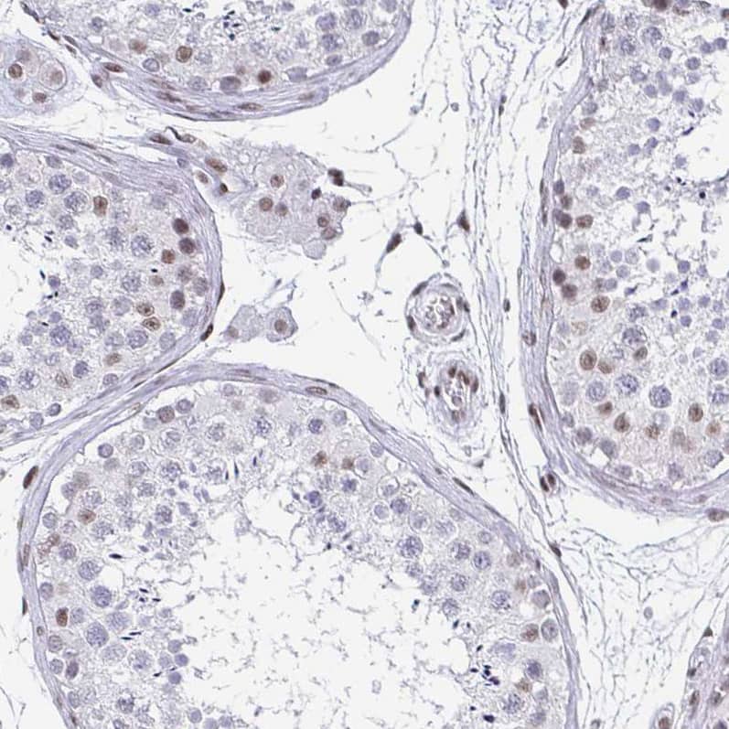 Staining of human testis shows moderate nuclear positivity in a subset of cells in seminiferous ducts.
