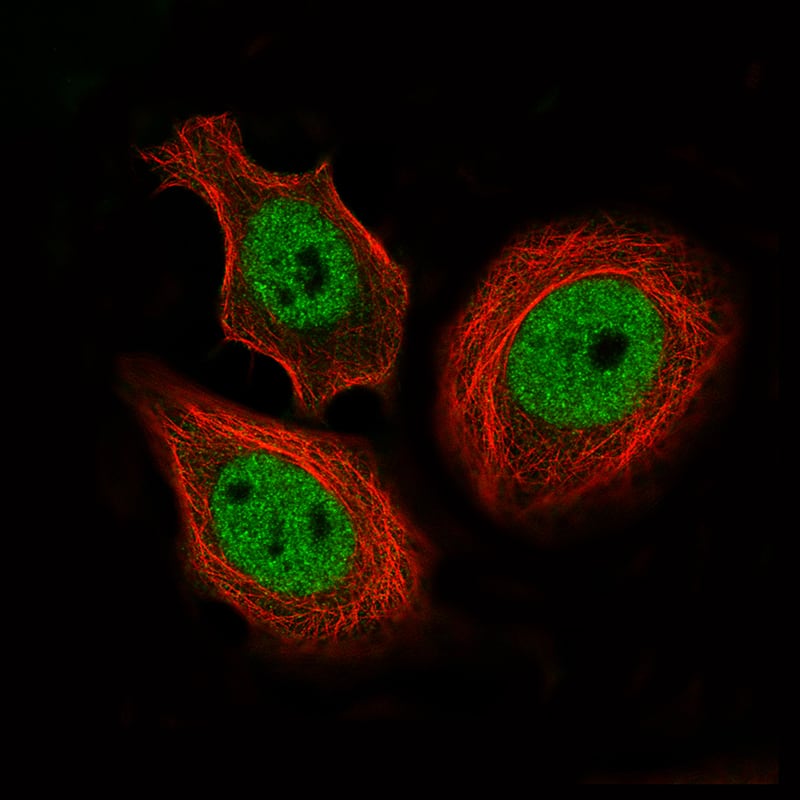 Staining of MCF7 cells using the Anti-CTCF monoclonal antibody) .