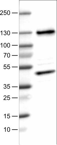 Lane 1: Marker [kDa]Lane 2: Human cell line U-251 MG