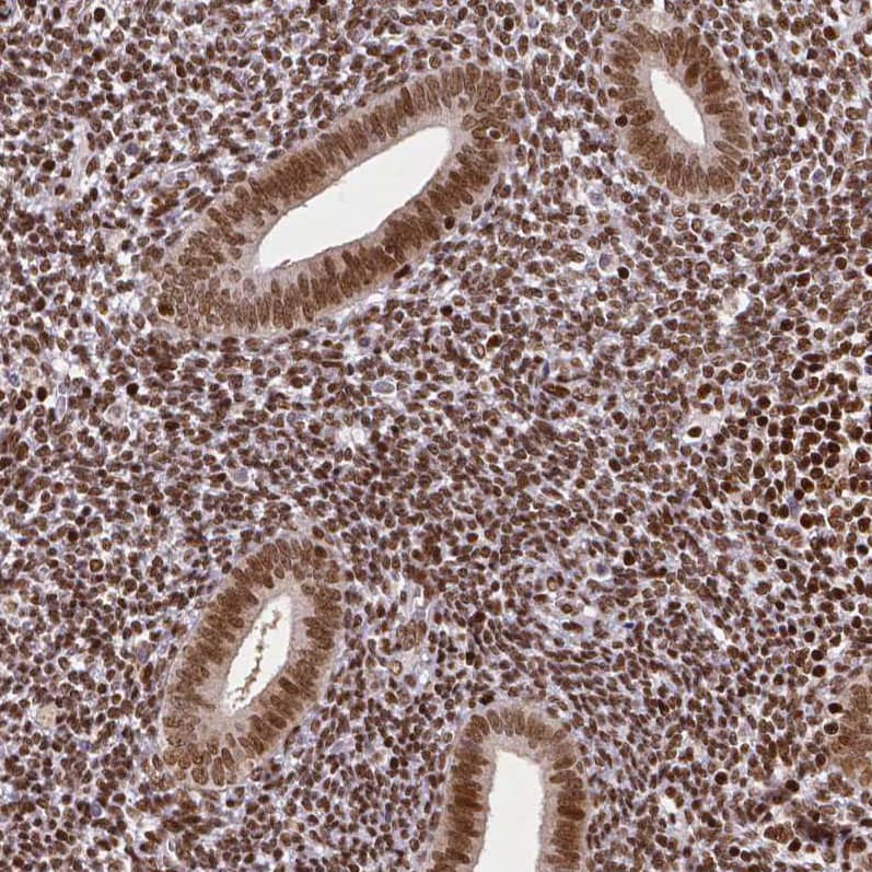 Staining of human endometrium shows moderate nuclear positivity in glandular and stromal cells.