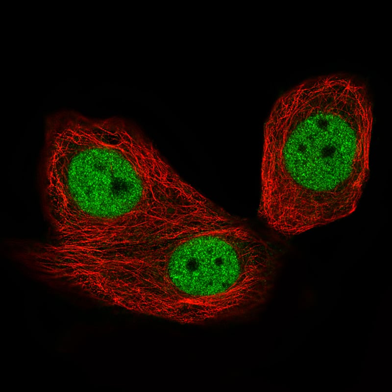 Staining of MCF7 cells using the Anti-CTCF monoclonal antibody) .
