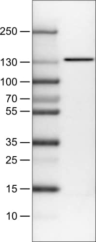 Lane 1: Marker [kDa]Lane 2: Human cell line U-251 MG