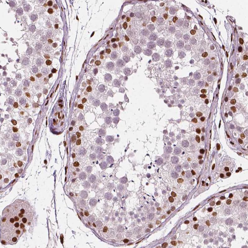 Staining of human testis shows moderate nuclear positivity in a subset of cells in seminiferous ducts.